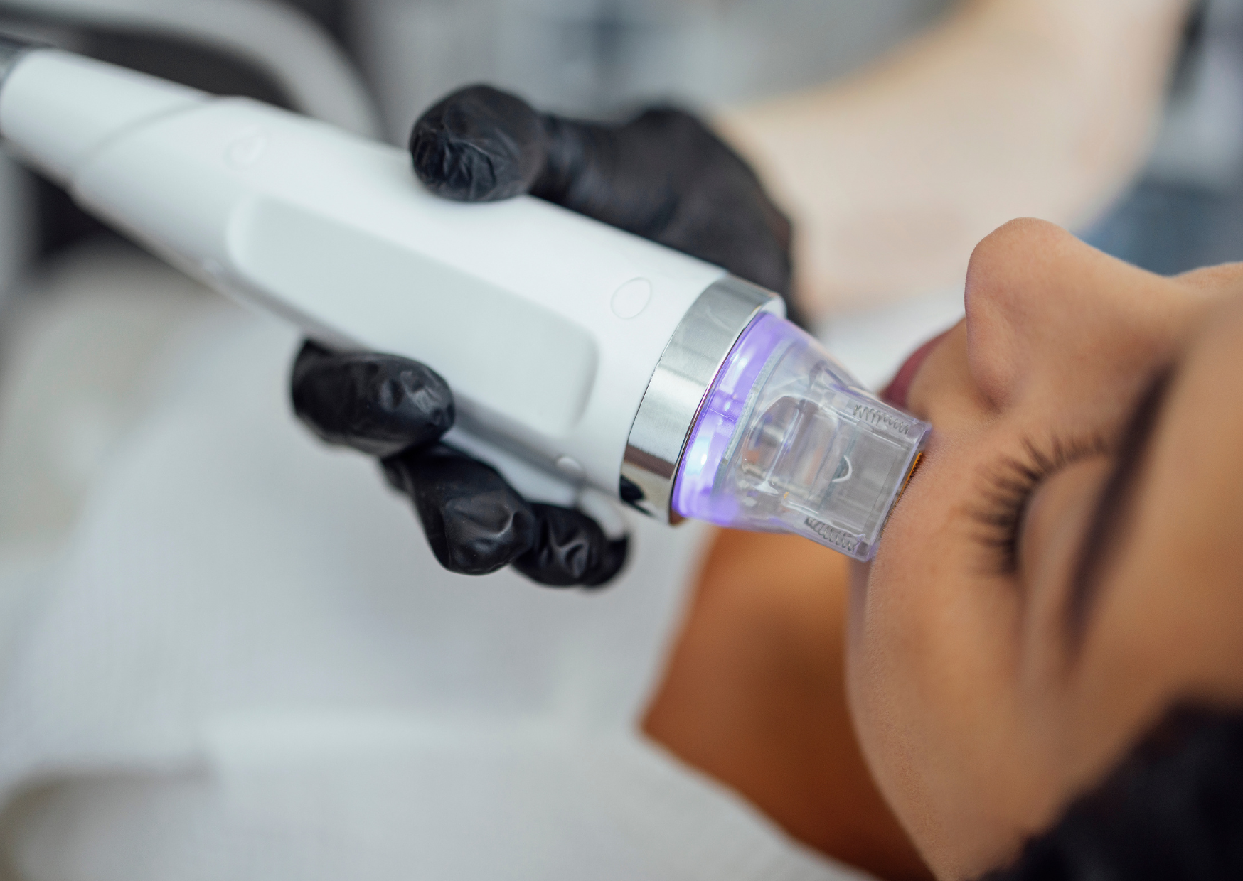 美FDA警告：熱門美容療程恐致灼傷與毀容